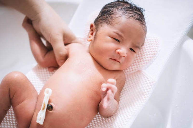 Umbilical Cord Care: What New Parents Need To Know